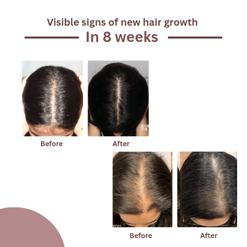 MEEM Organic & Herbal Hair Oil